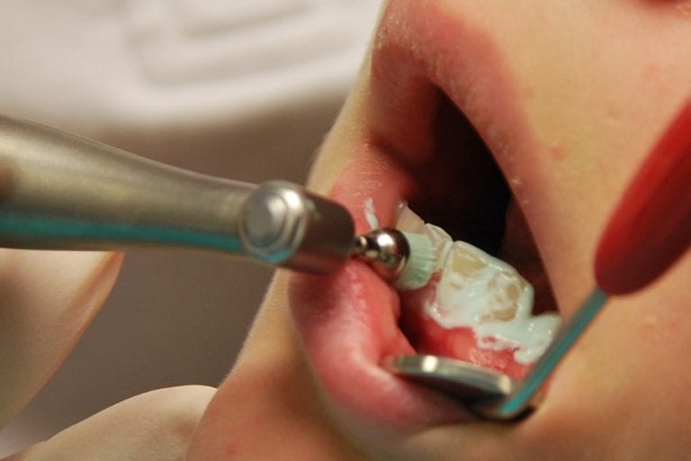 Quais os métodos de prevenção da cárie dentária?