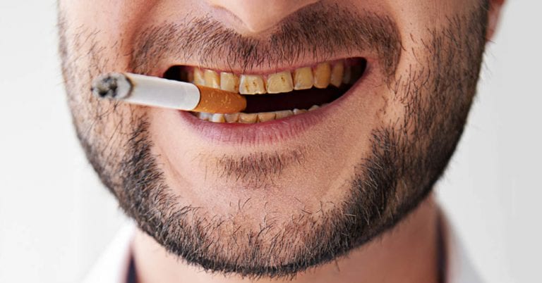 Malefícios do cigarro para sua saúde bucal