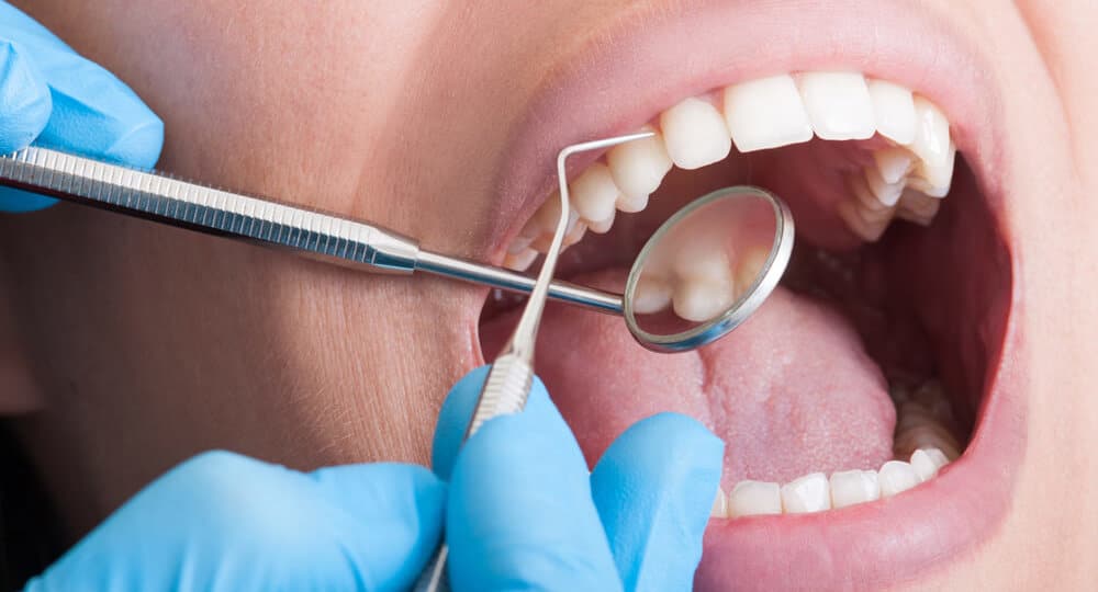 Exame clínico na arcada dentária