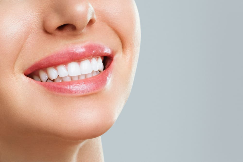 Benefícios do Clareamento dental