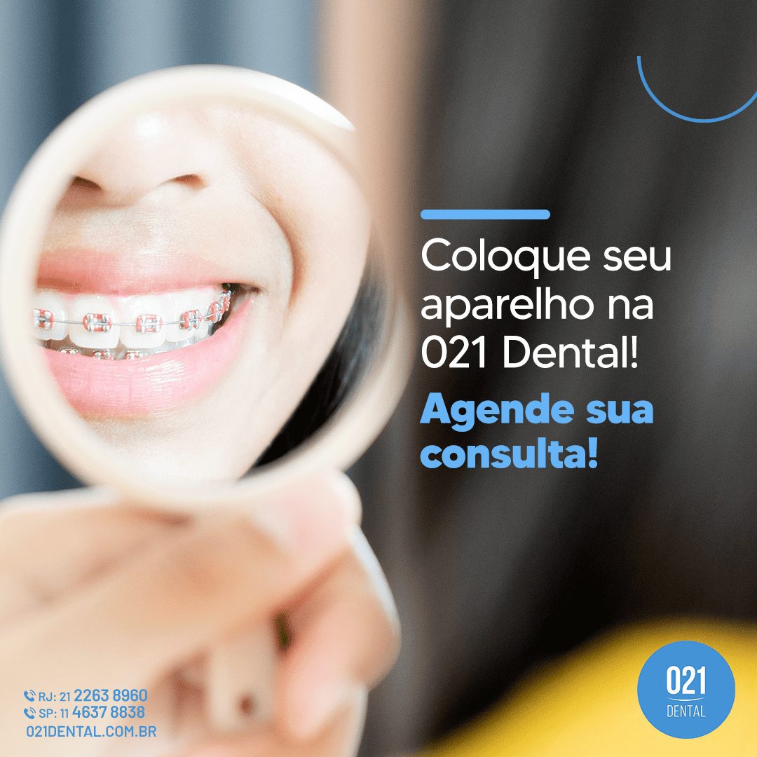 Preciso usar contenção depois do tratamento ortodôntico? - Aquarela  Odontologia Brasília