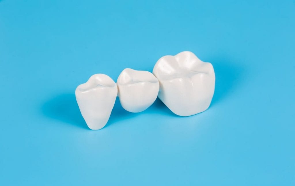 Dentes de porcelana