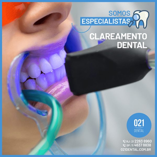 Tudo sobre clareamento dental - Agende sua consulta! 021 Dental