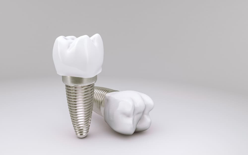 Tipos de implante dentário