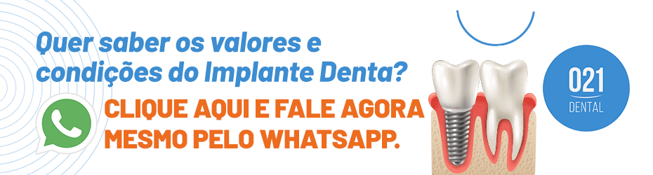 banner whatsapp implante dental