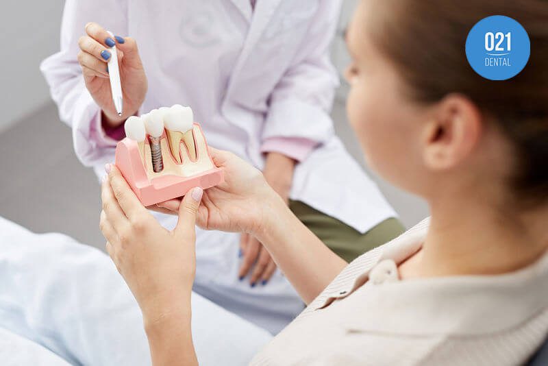 Qual o implante dental mais indicado?
