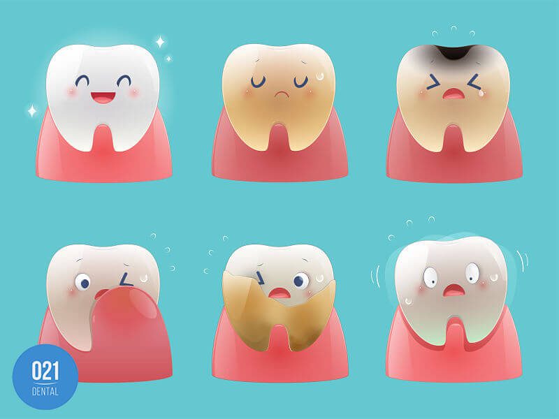 Ilustração de dentes que demonstram os sintomas da gengiva inflamada