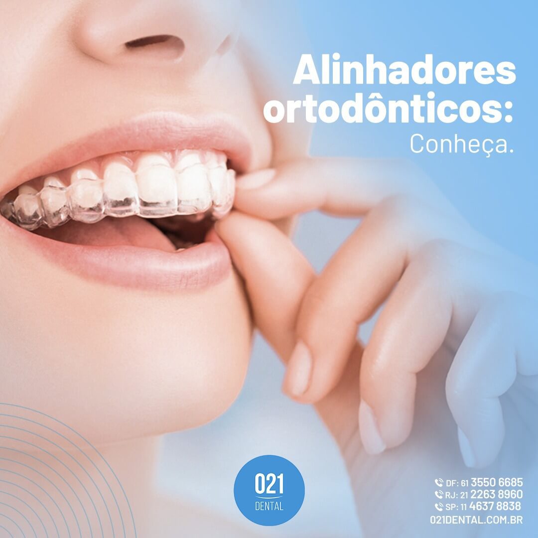 https://021dental.com.br/wp-content/uploads/2021/10/Alinhadores-transparentes-ortodonticos-1.jpeg