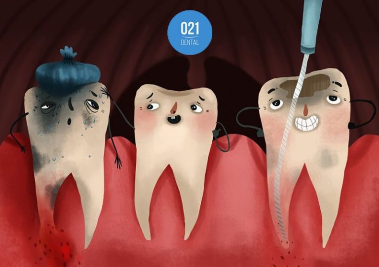 ilustração de dentes tendo a necrose pulpar sendo tratada