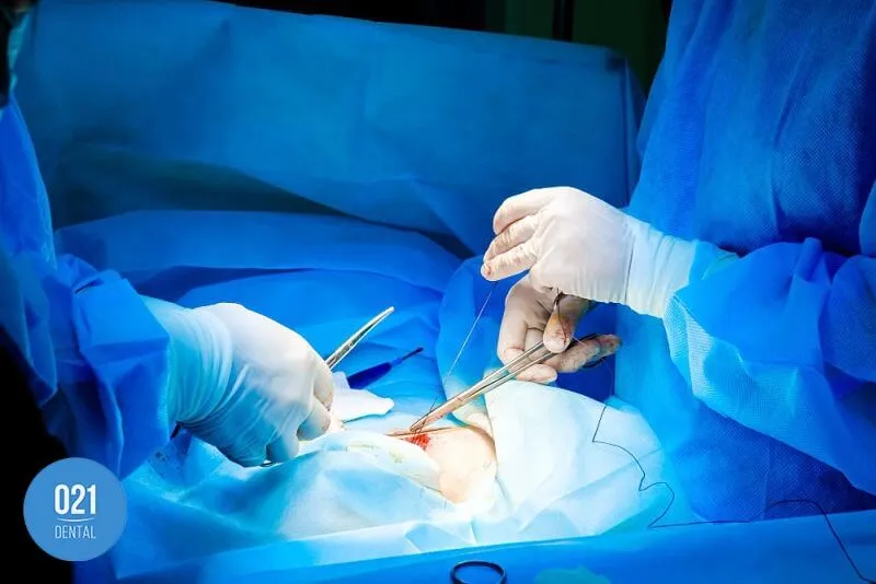 Imagem de cirurgiões removendo sutura do siso