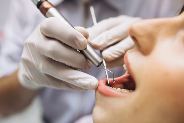Profilaxia Dental Entenda sua Importância e Benefícios para a Saúde Bucal