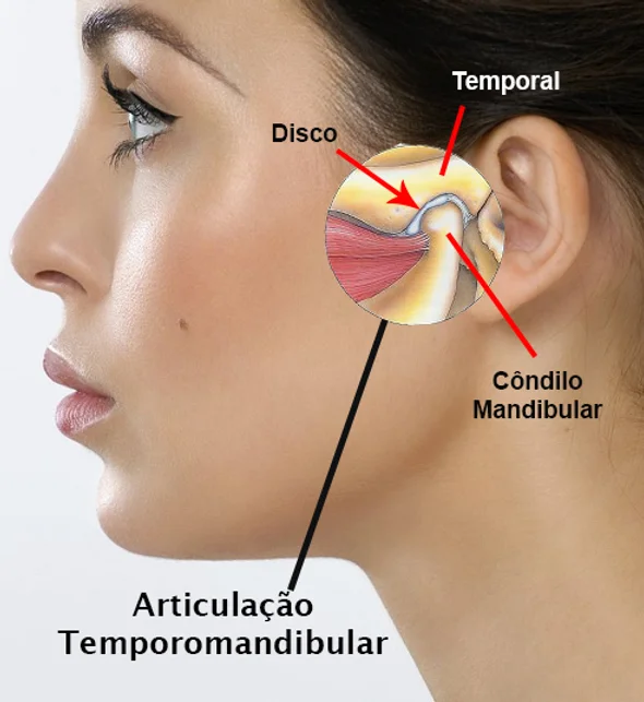 O que é Articulação Temporomandibular?