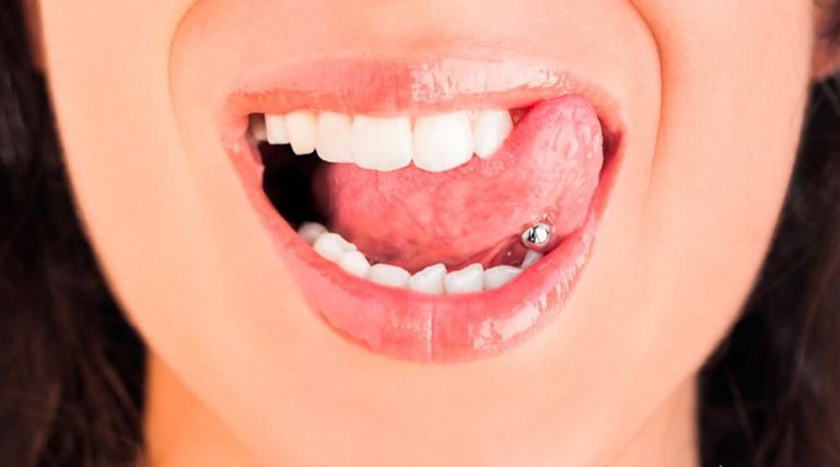 Piercing na língua Como afeta os dentes cuidados simples